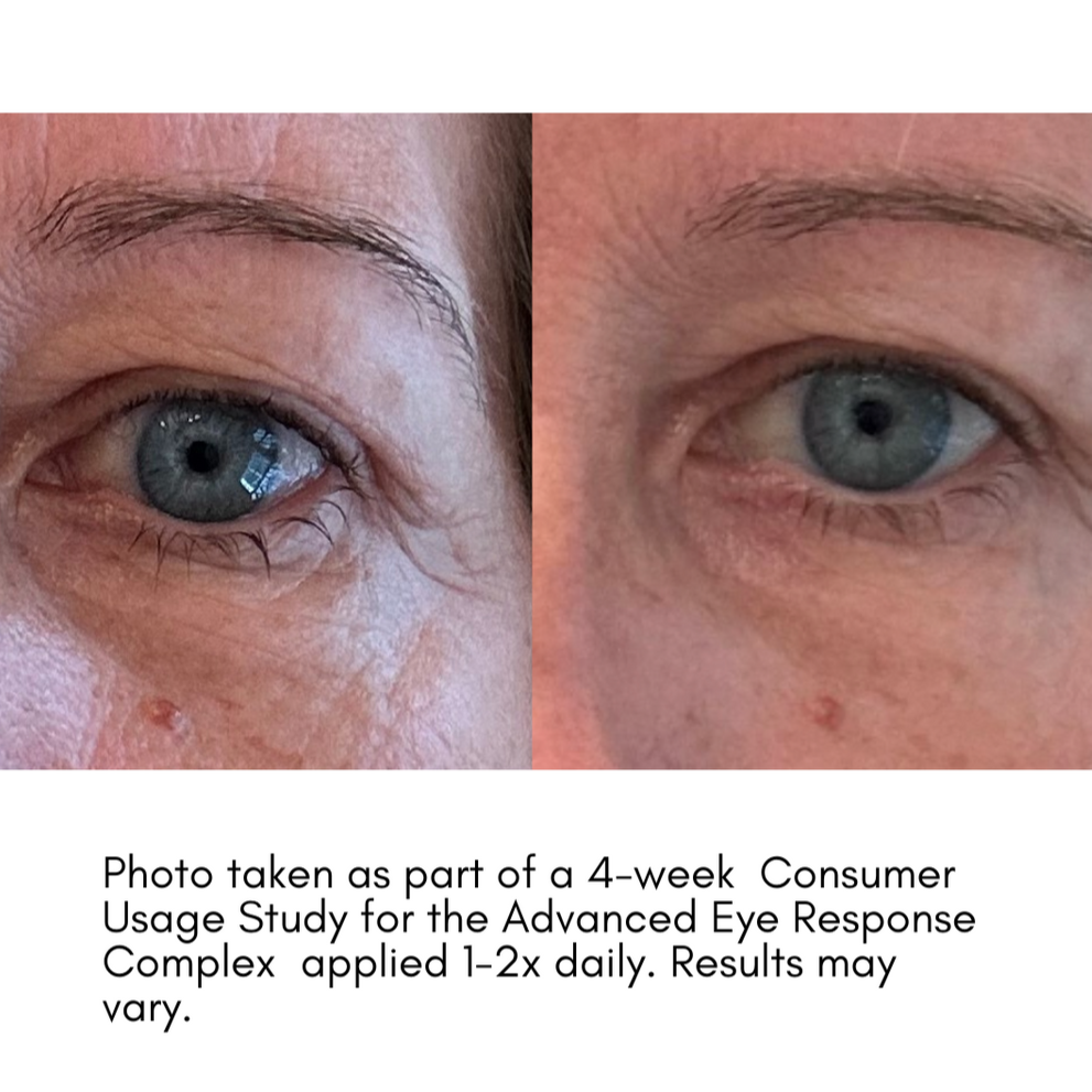 The Advanced Eye Response Complex