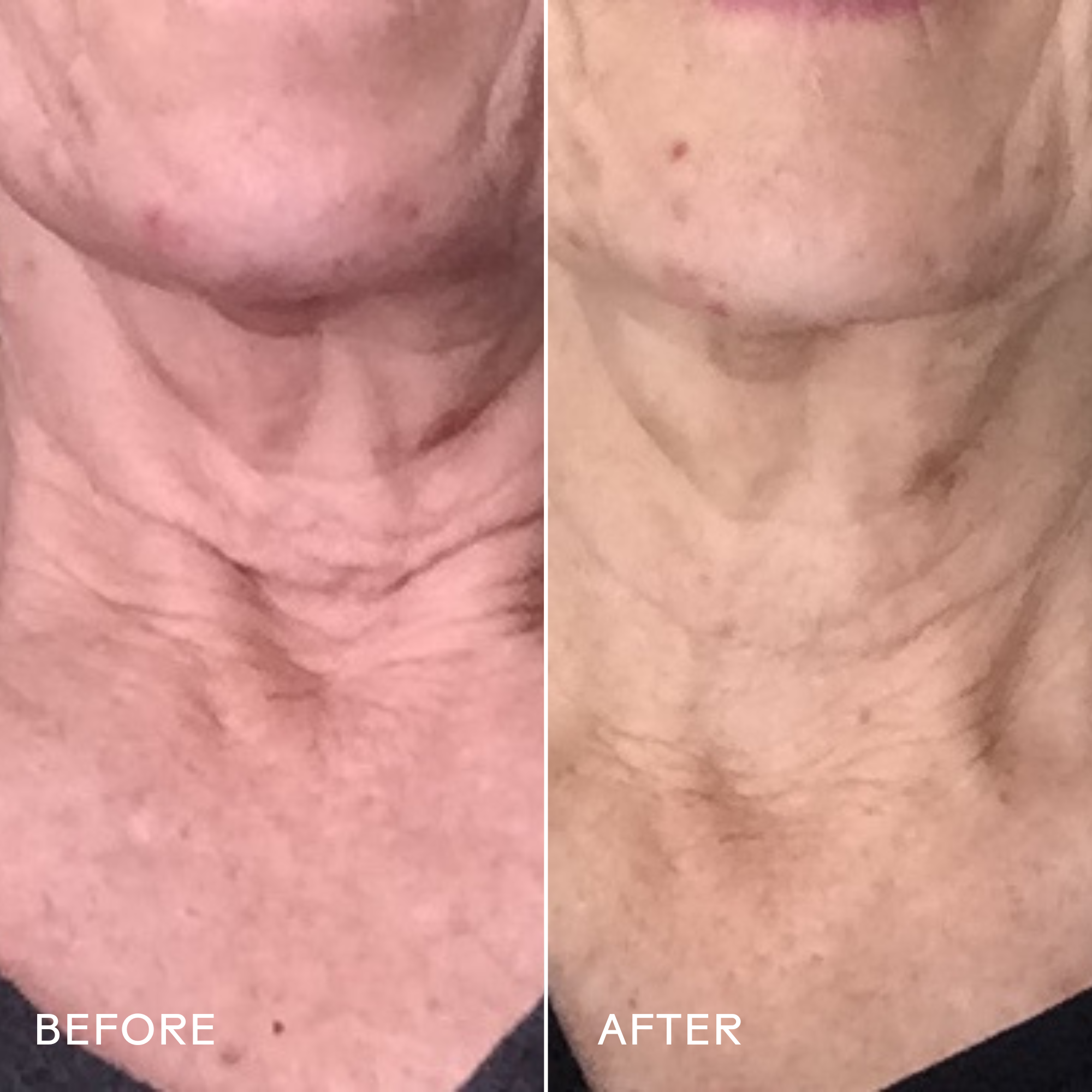 Firm Believer Smoothing Neck + Face Cream