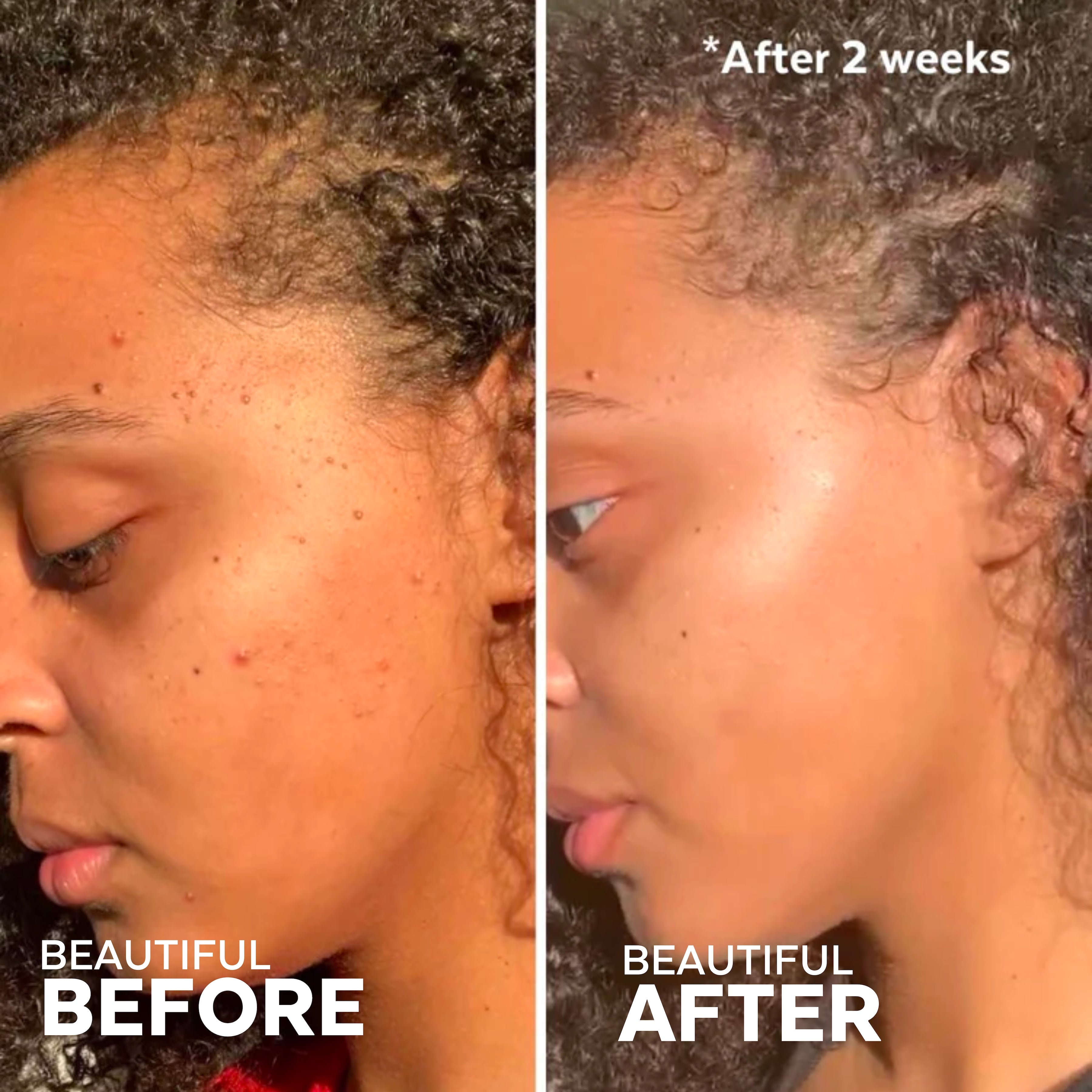 Superfruit AHA Exfoliating Mask