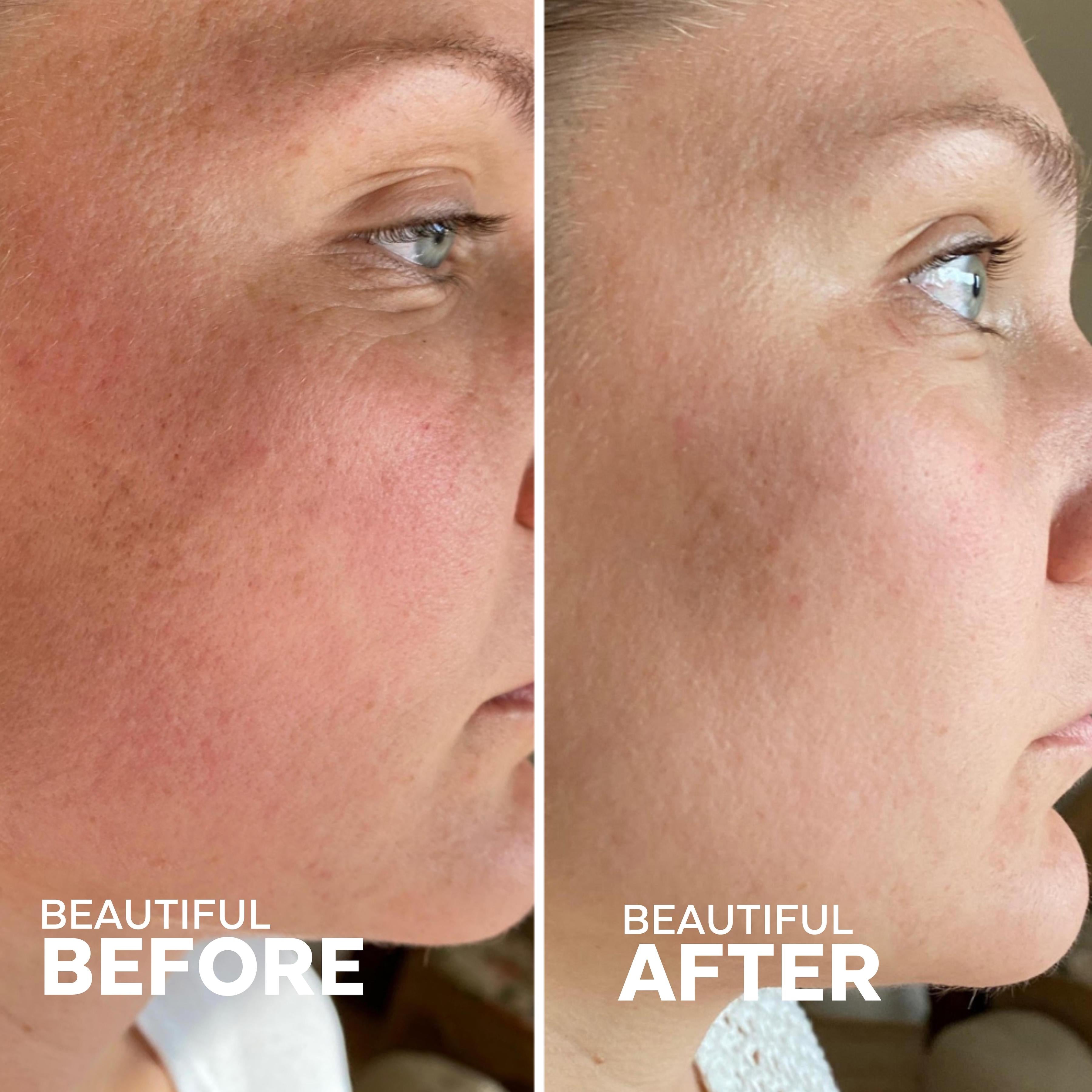 SkinHero Bakuchiol + Calendula Serum