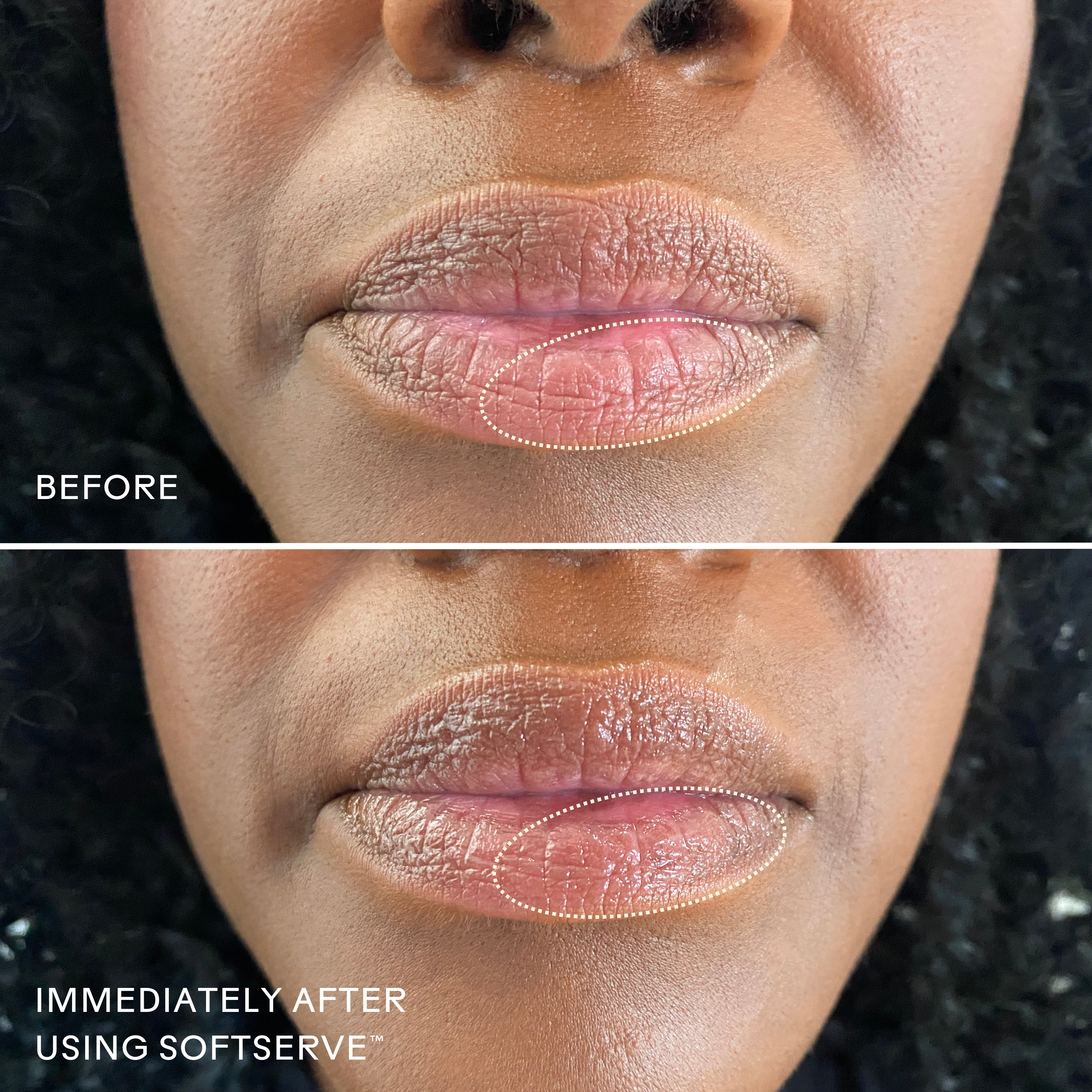 SoftServe Pomegranate + Shea Butter Lip Treatment