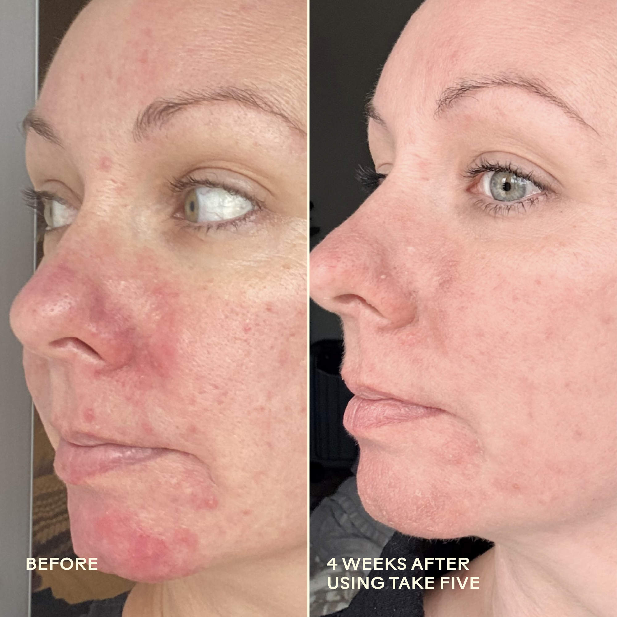Take Five Hypochlorous Acid Balancing Body + Face Spray