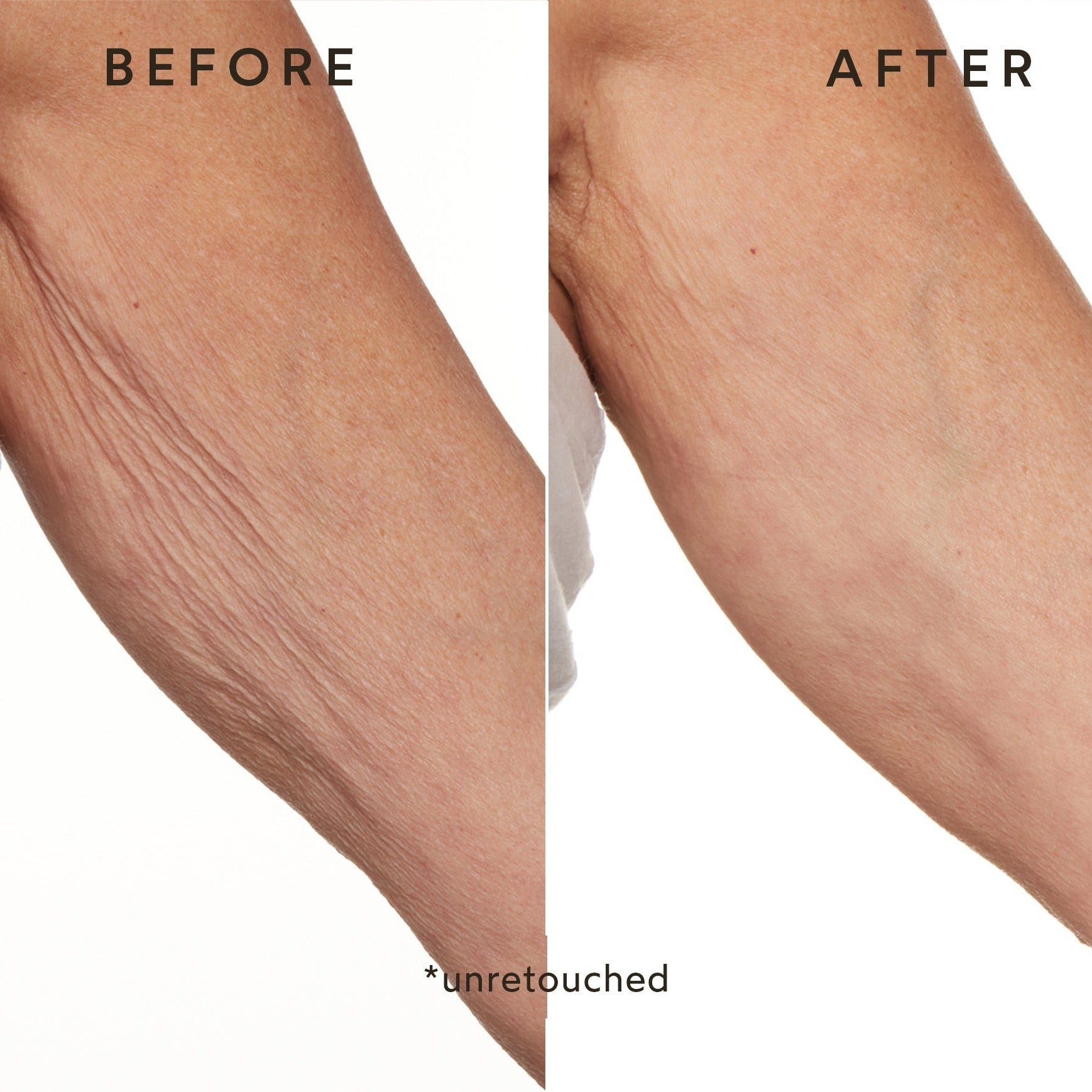 Phyto-Retinol Anti-Aging Body Lotion