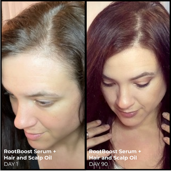 Better Roots Serum and Oil Duo