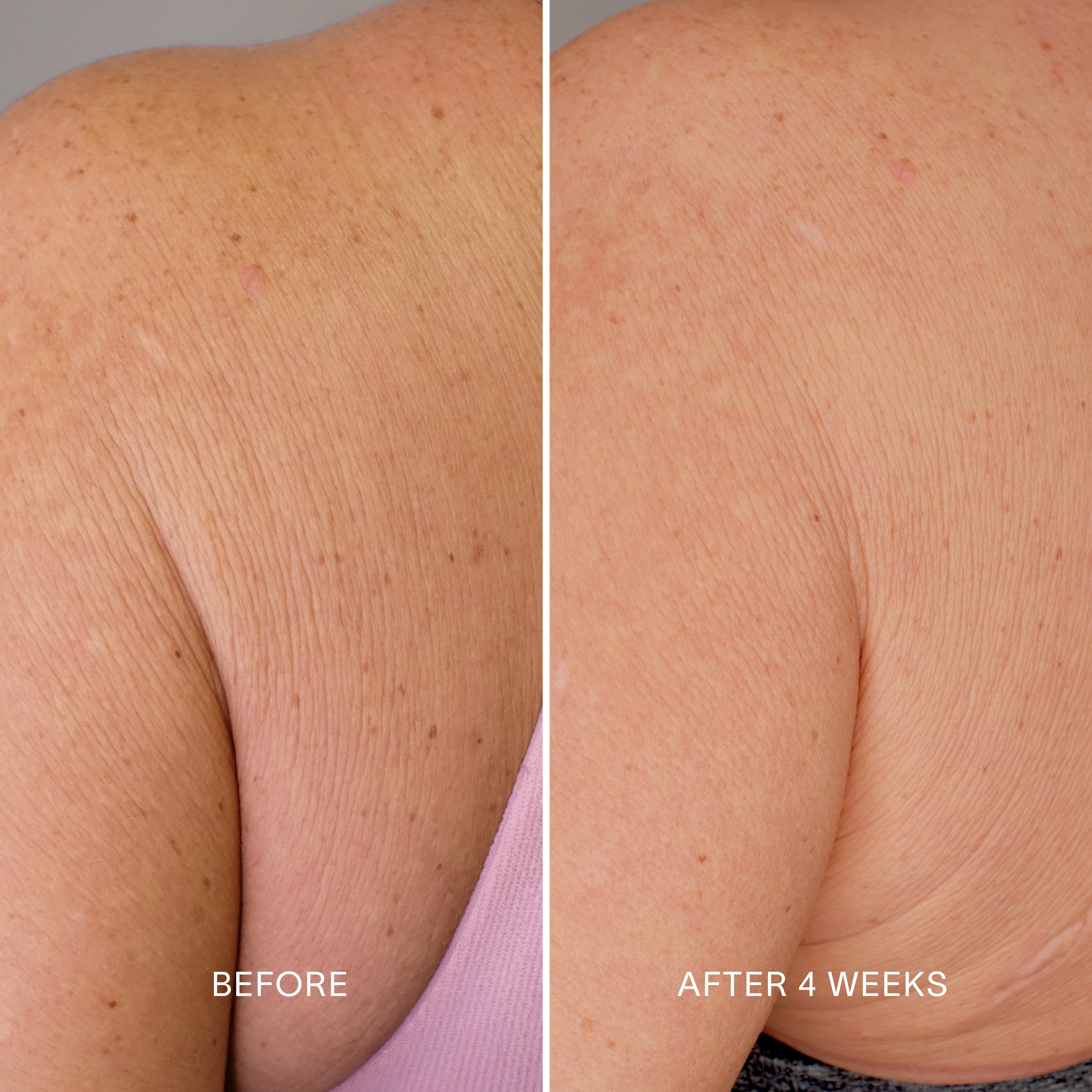 Body Repair Treatment
