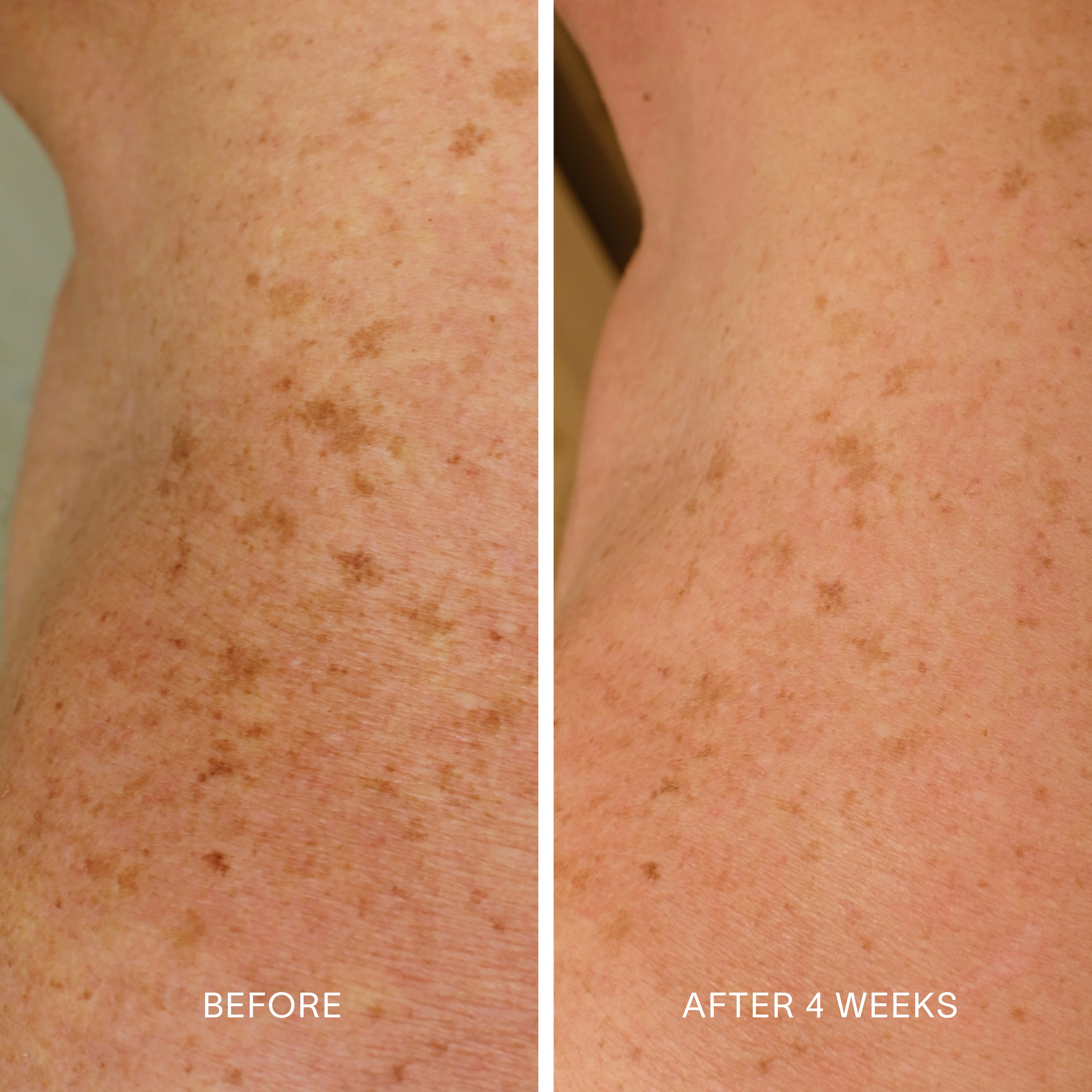 Body Repair Treatment
