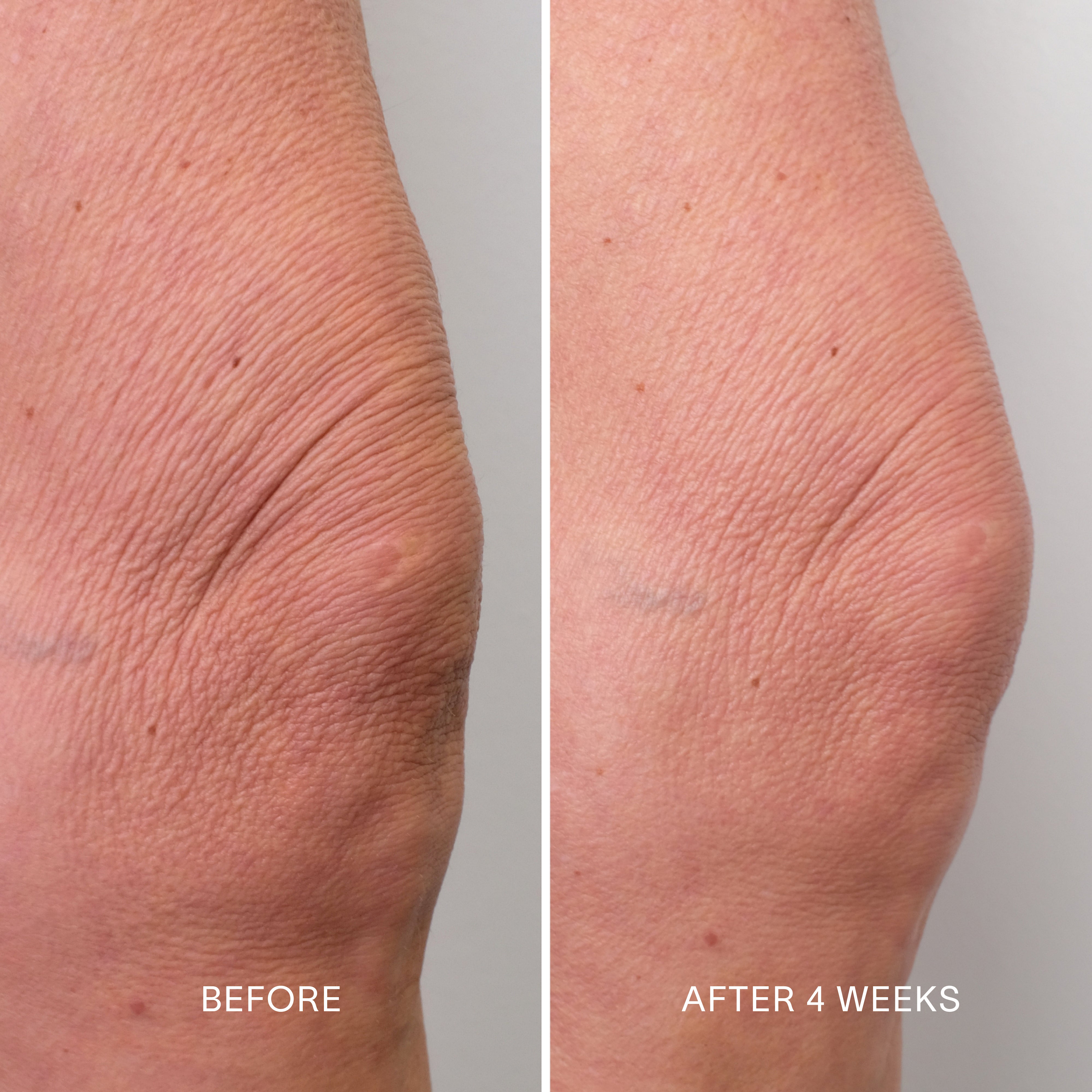 Body Repair Treatment
