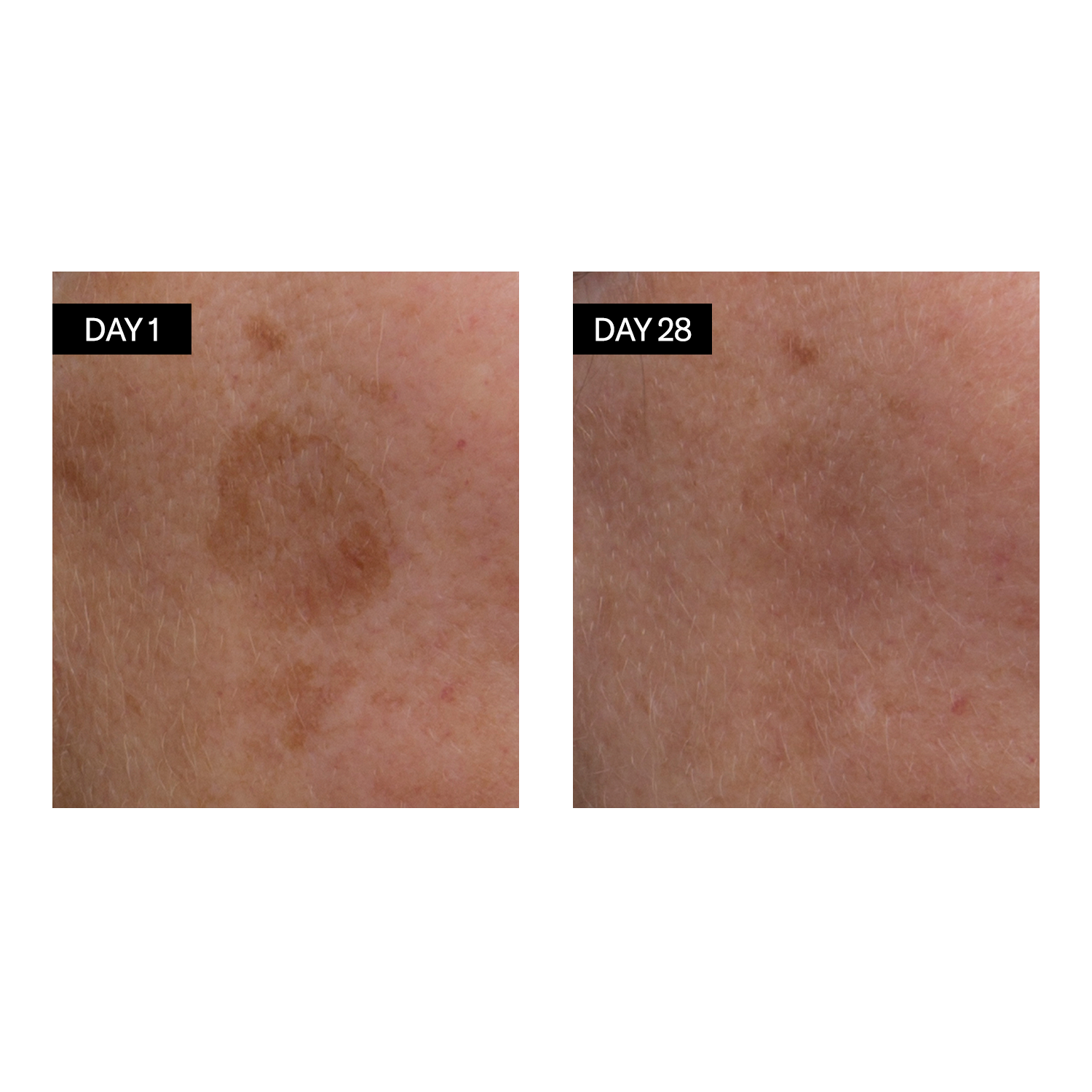 Vitamin C & E + Hyaluronic Acid Brightening Serum
