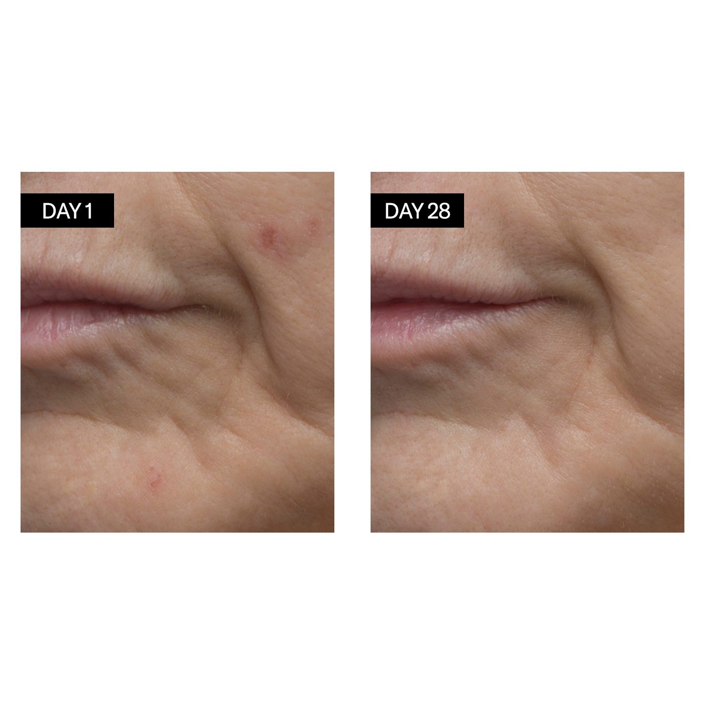 Retinol + Hyaluronic Acid Renewing Serum