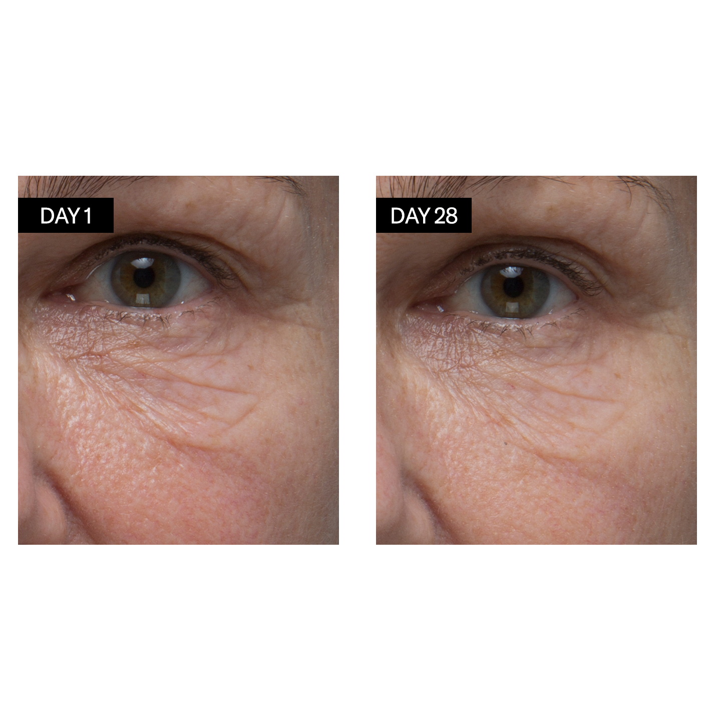 Retinol + Hyaluronic Acid Renewing Serum