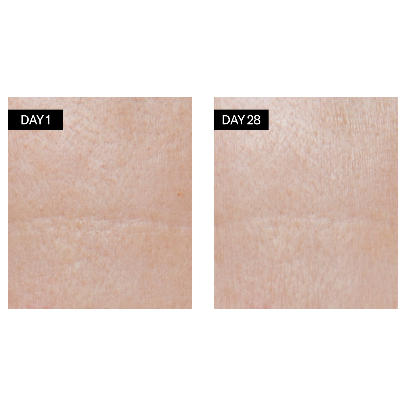 Retinol + Hyaluronic Acid Renewing Serum