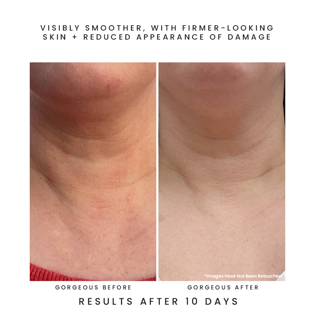 Earth Harbor | Azure Peptide Smoothing Water Cream | Before & After Image - before-and-after comparison of neck and chest skin showing a smoother-looking appearance after 10 days