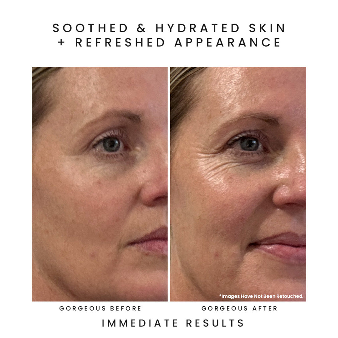 Earth Harbor | Tidal Rose Seaweed Hydration Mist | Before and After Image - side-by-side close-up images showing skin before and after application