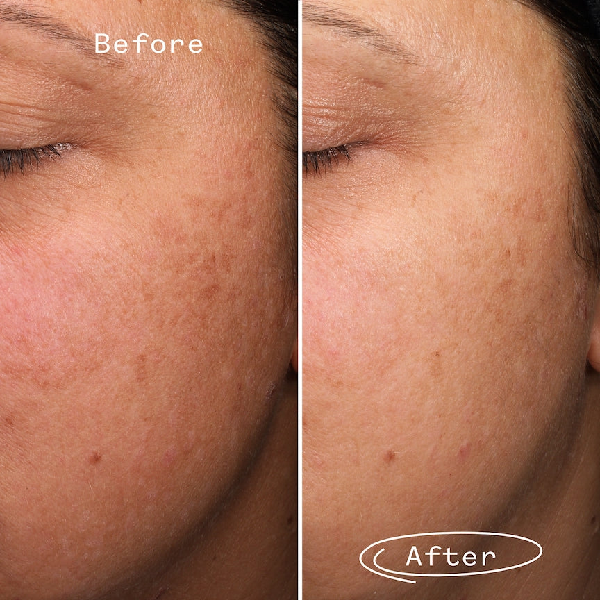 Fade Forward Dark Spot Serum