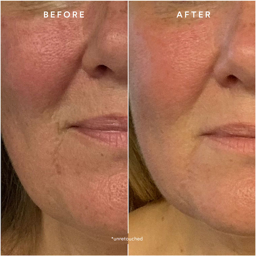 Renew Repair Nightly Treatment