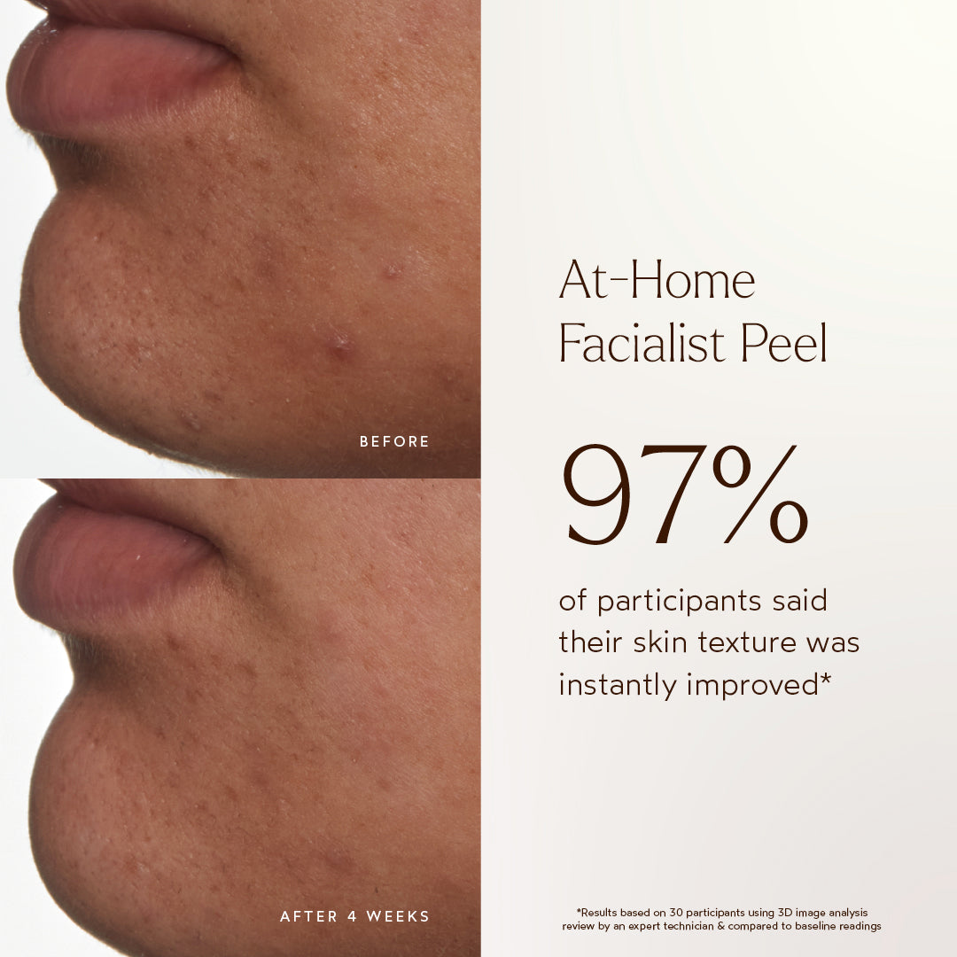 At-Home Facialist Peel