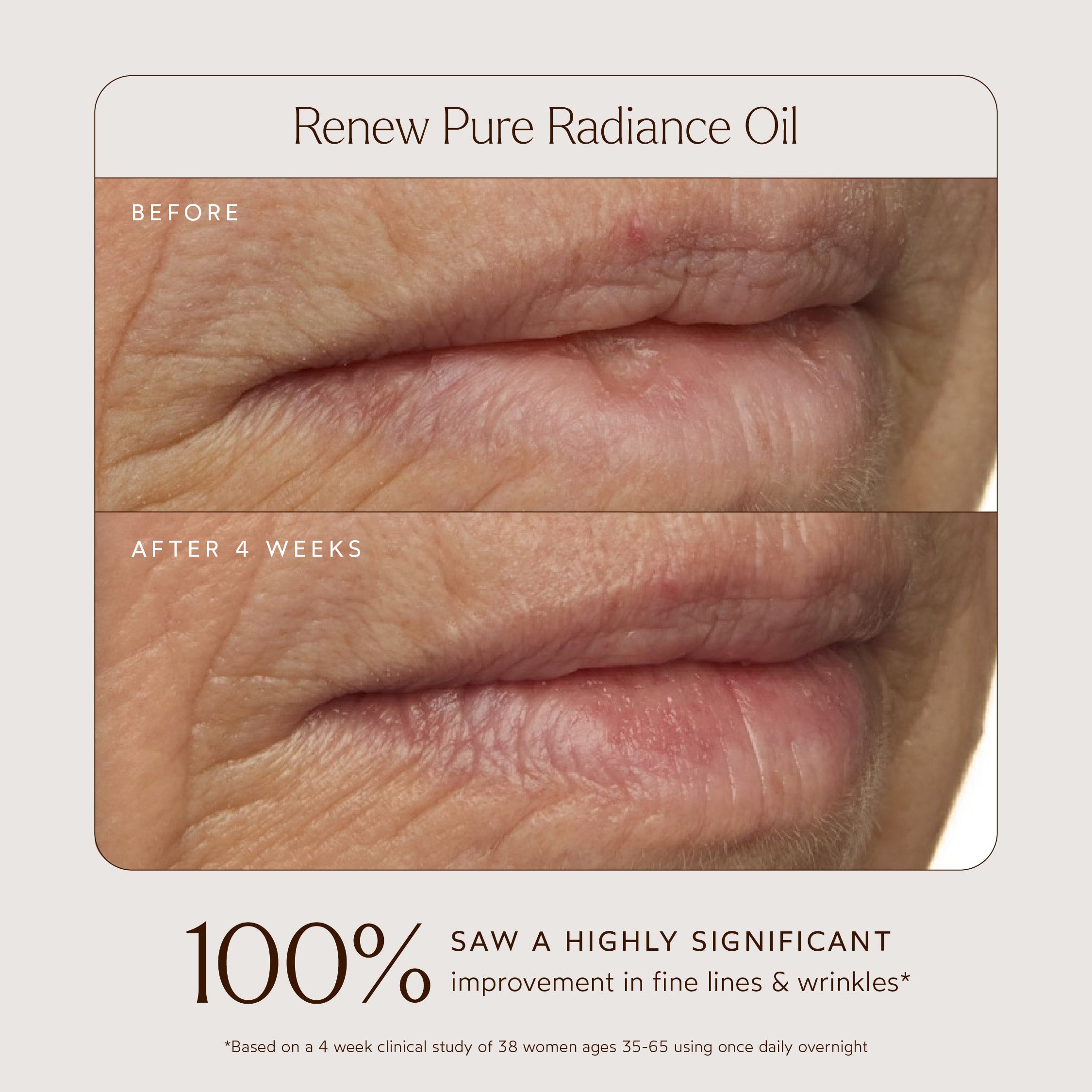 Pure Radiance Overnight Lip Treatment