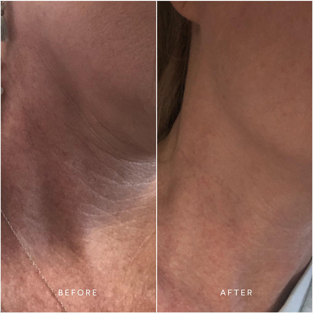 Renew Repair Nightly Treatment