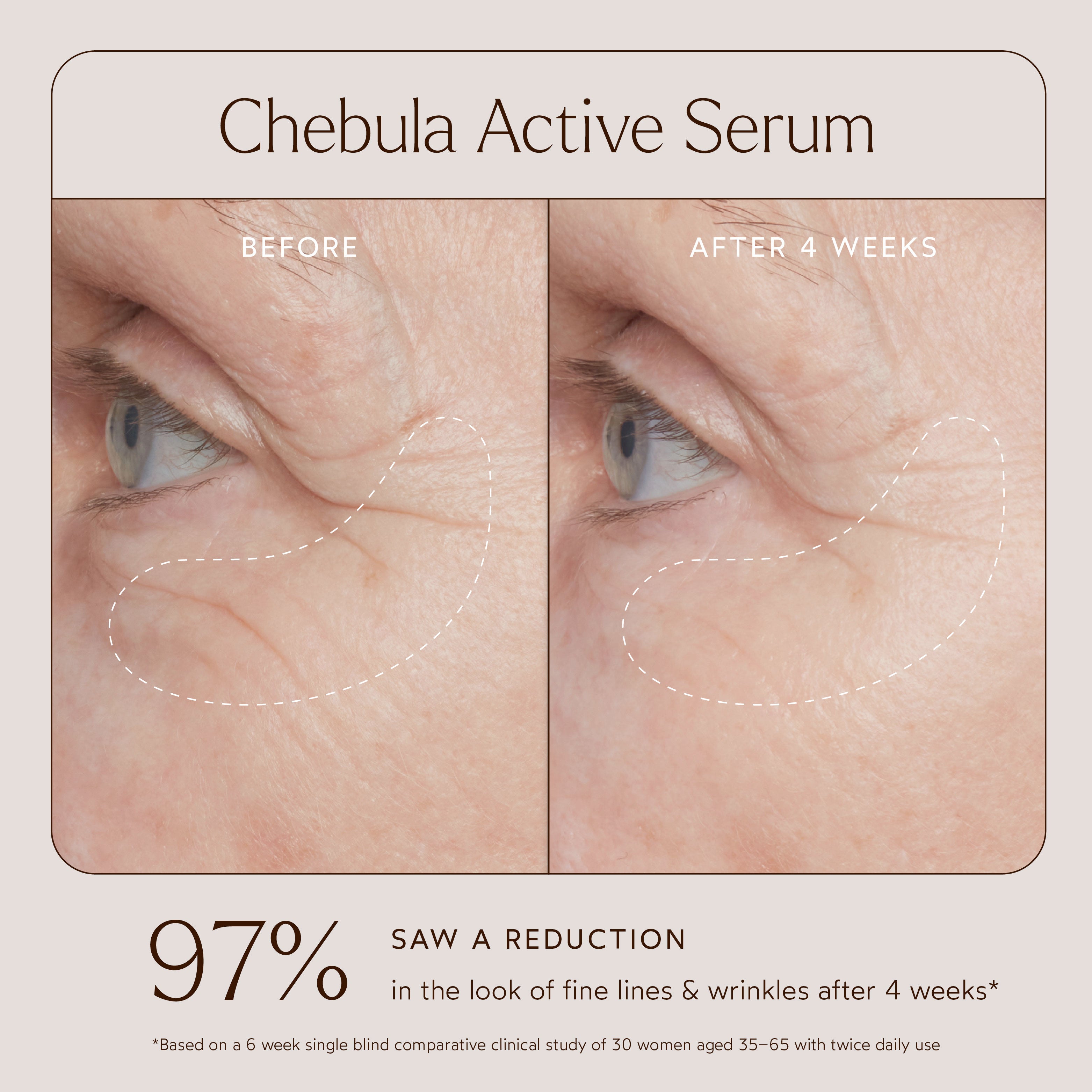 Renew Chebula Active Serum