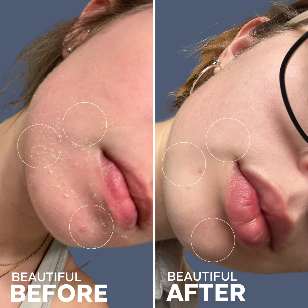 SkinHero Bakuchiol + Calendula Serum