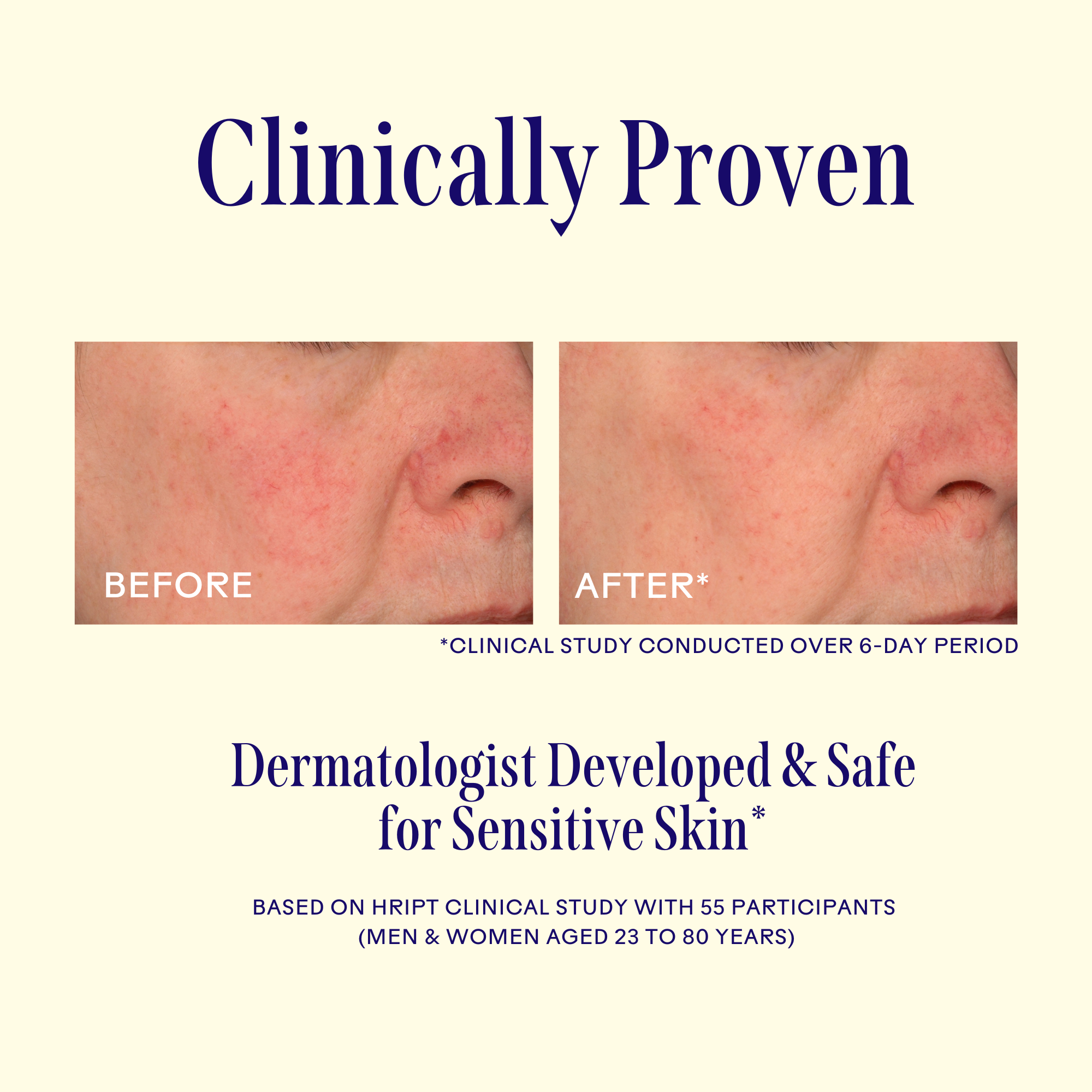 Three Ships | Replenish Barrier Serum | Clinical Study Image - before and after clinical study results on sensitive skin