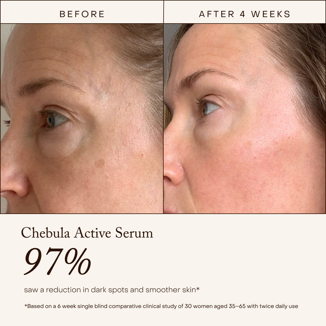 True Botanicals | A True Transformation Kit | Before and After Image - fefore and after 4 weeks using True Botanicals Chebula Active Serum