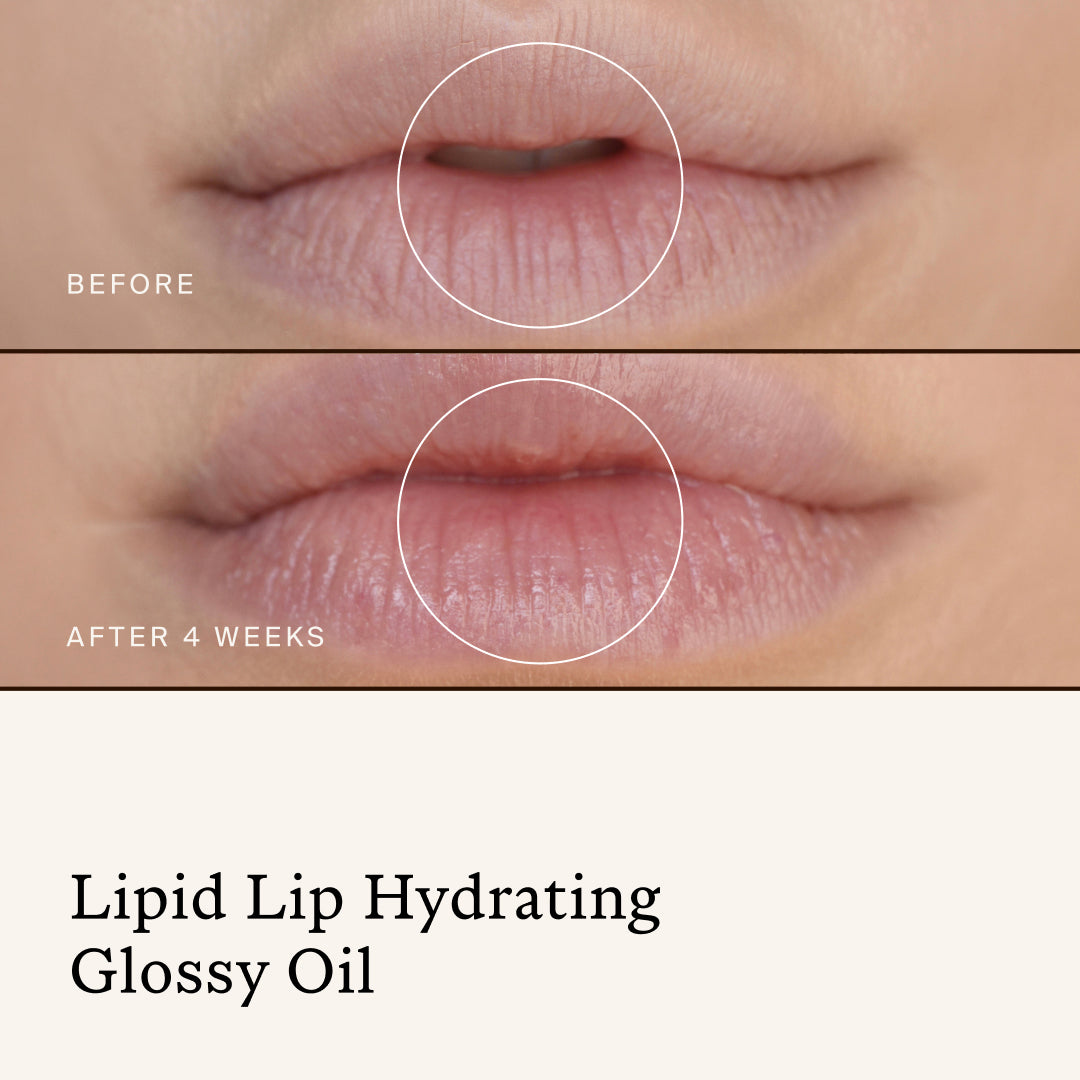 True Botanicals | Stocking Stuffer Best Sellers Lip Duo | Lipid Lip Results -
before-and-after close-up of lips after four weeks of using Lipid Lip Hydrating Glossy Oil