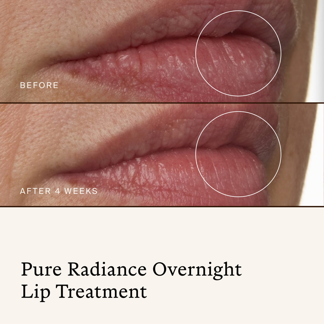 True Botanicals | Stocking Stuffer Best Sellers Lip Duo | Overnight Lip Results
- before-and-after close-up of lips after four weeks of using Pure Radiance Overnight Lip Treatment