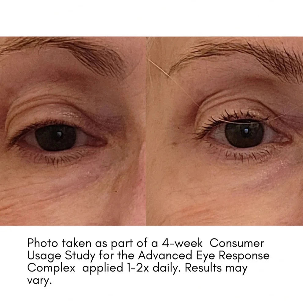 The Advanced Eye Response Complex