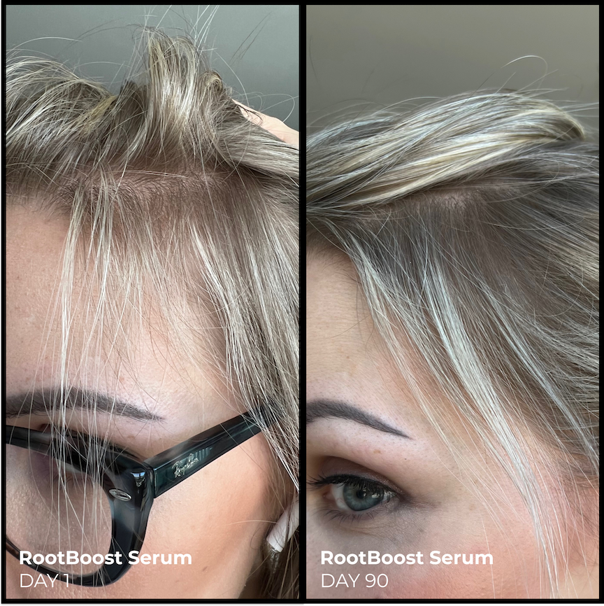 Better Roots RootBoost Complex