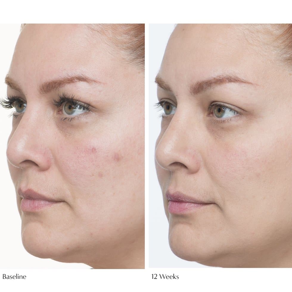 Plumscreen SPF 31 - Beauty Heroes®