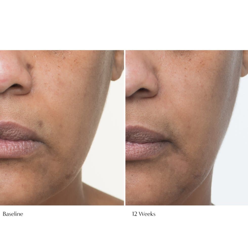 Plumscreen SPF 31 - Beauty Heroes®