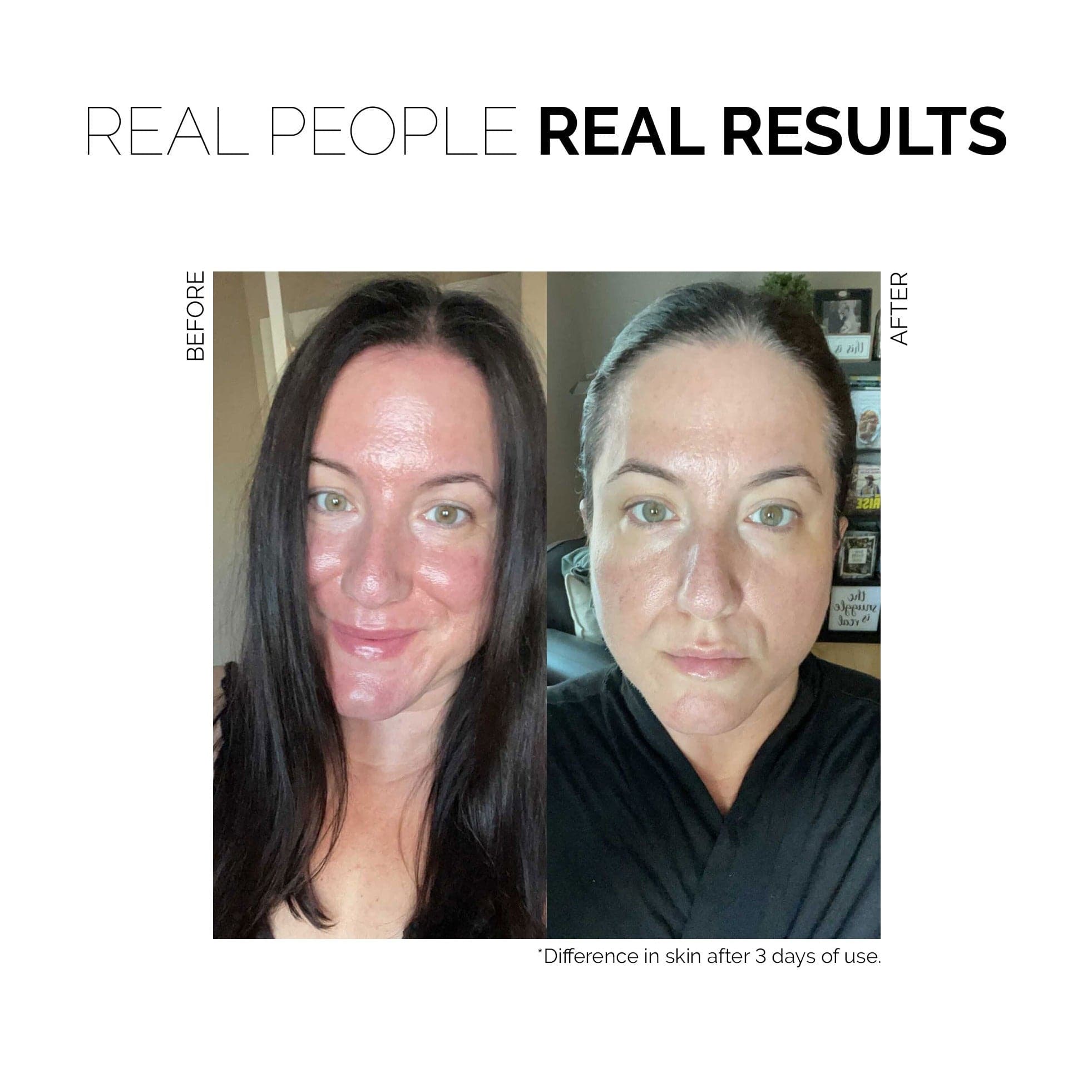 Redness Rescue Cream - Beauty Heroes®