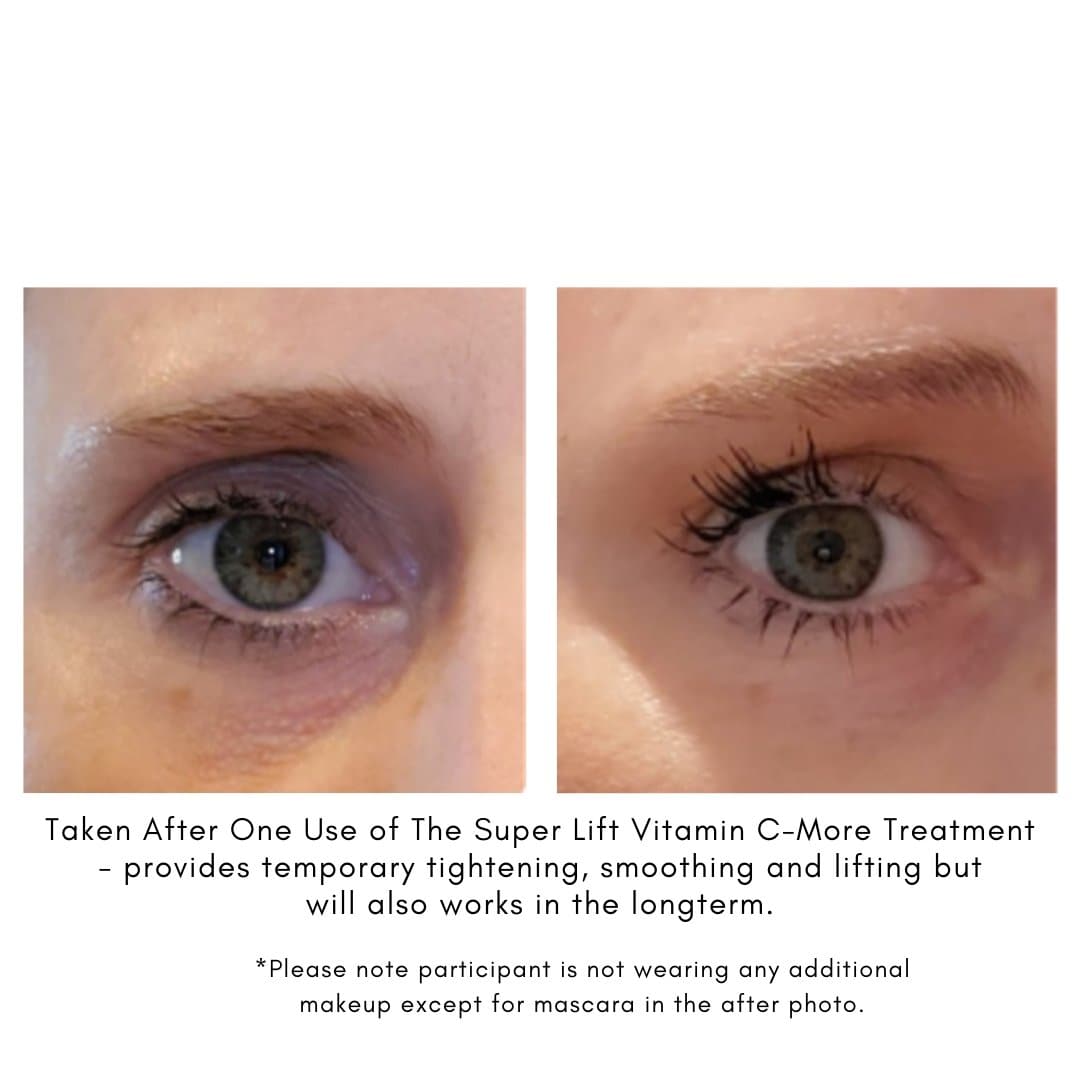 The Super Lift Vitamin C-More Treatment - Beauty Heroes®