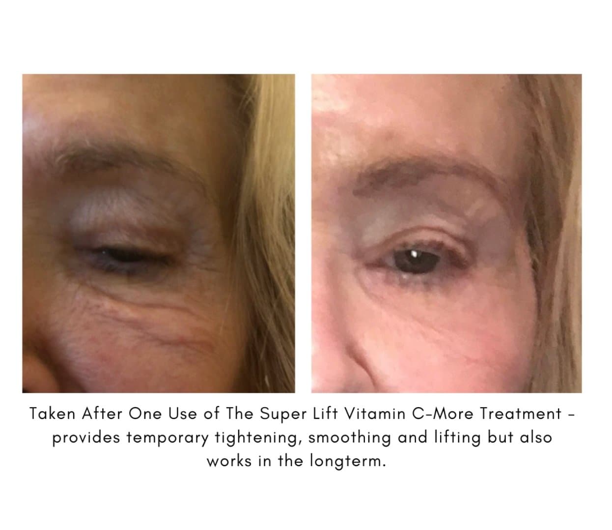 The Super Lift Vitamin C-More Treatment - Beauty Heroes®