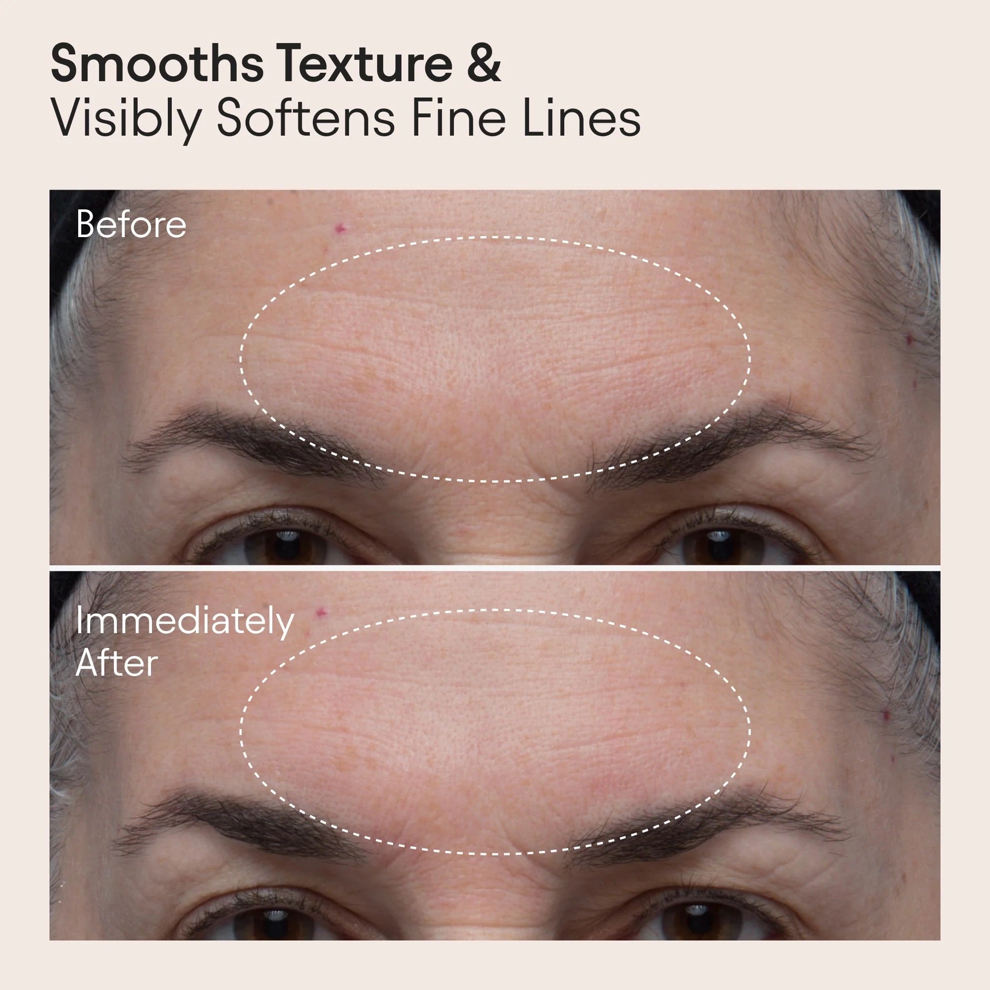 8 Acid Double Polishing Peel