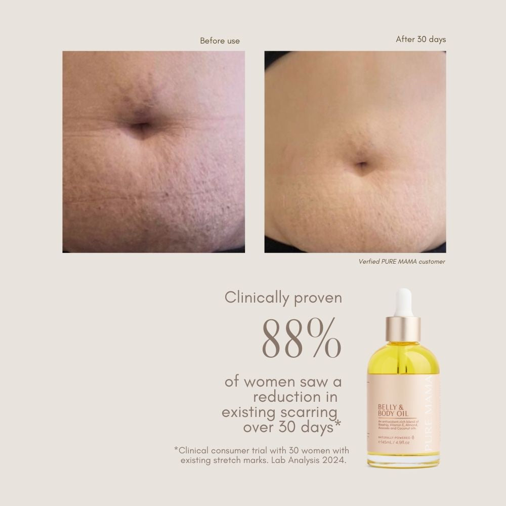 Belly & Body Oil | Pure Mama - Beauty Heroes