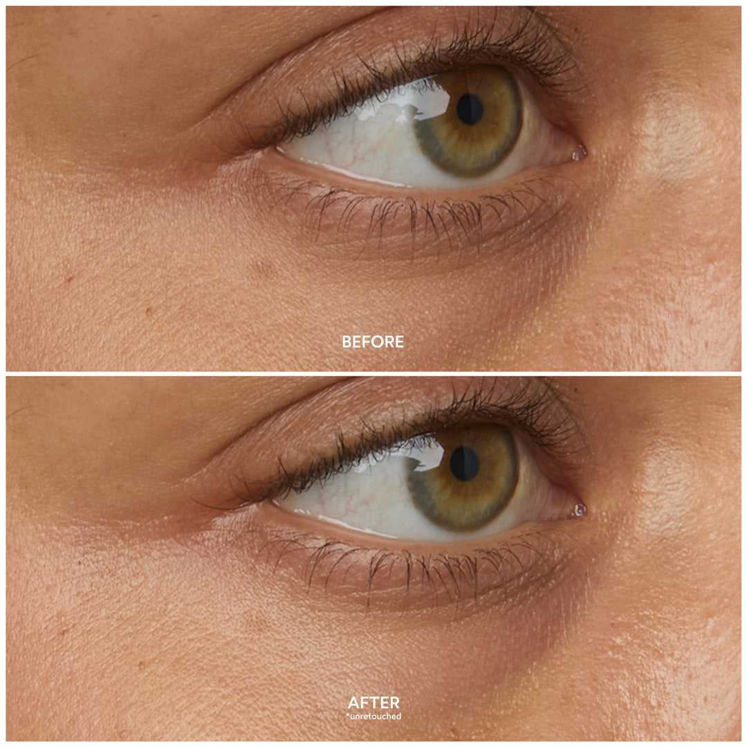 Chebula Multi-Corrective Eye Patches