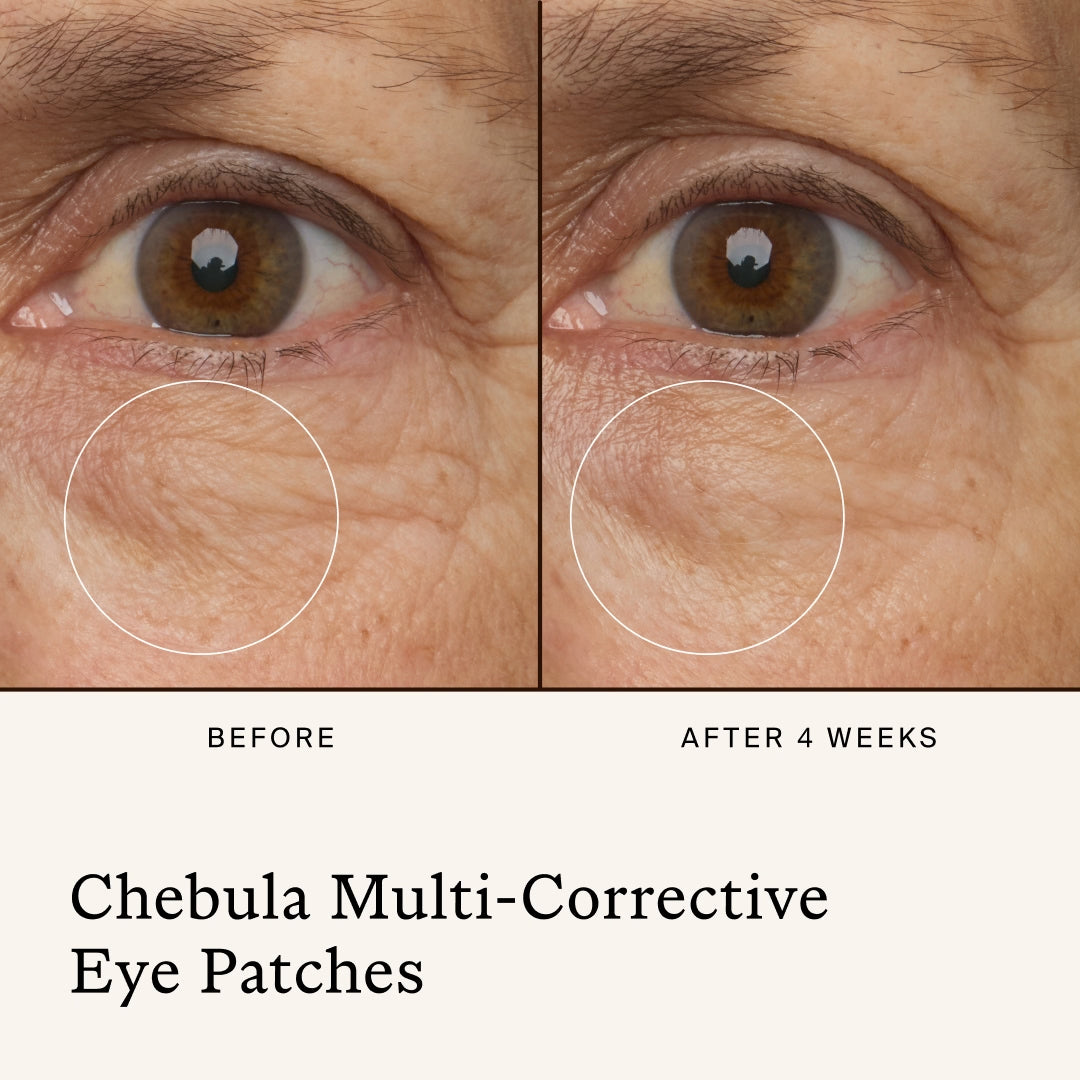 True Botanicals | Eye Collection | Chebula Multi-Corrective Eye Patches Results Image - Before-and-after eye area after four weeks of using Chebula Multi-Corrective Eye Patches.