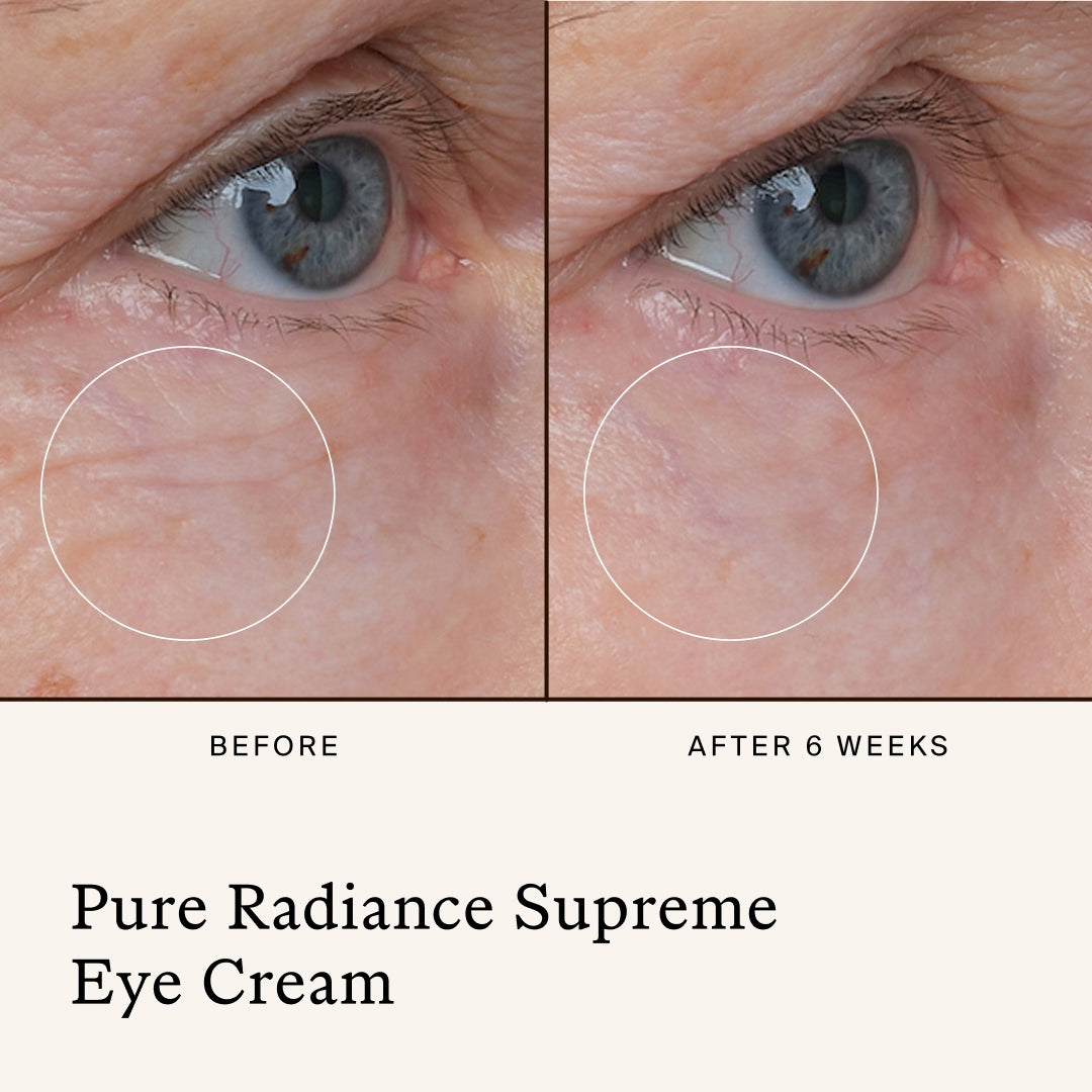 True Botanicals | Eye Collection | Pure Radiance Supreme Eye Cream Results Image - Before-and-after eye area after six weeks of using Pure Radiance Supreme Eye Cream.