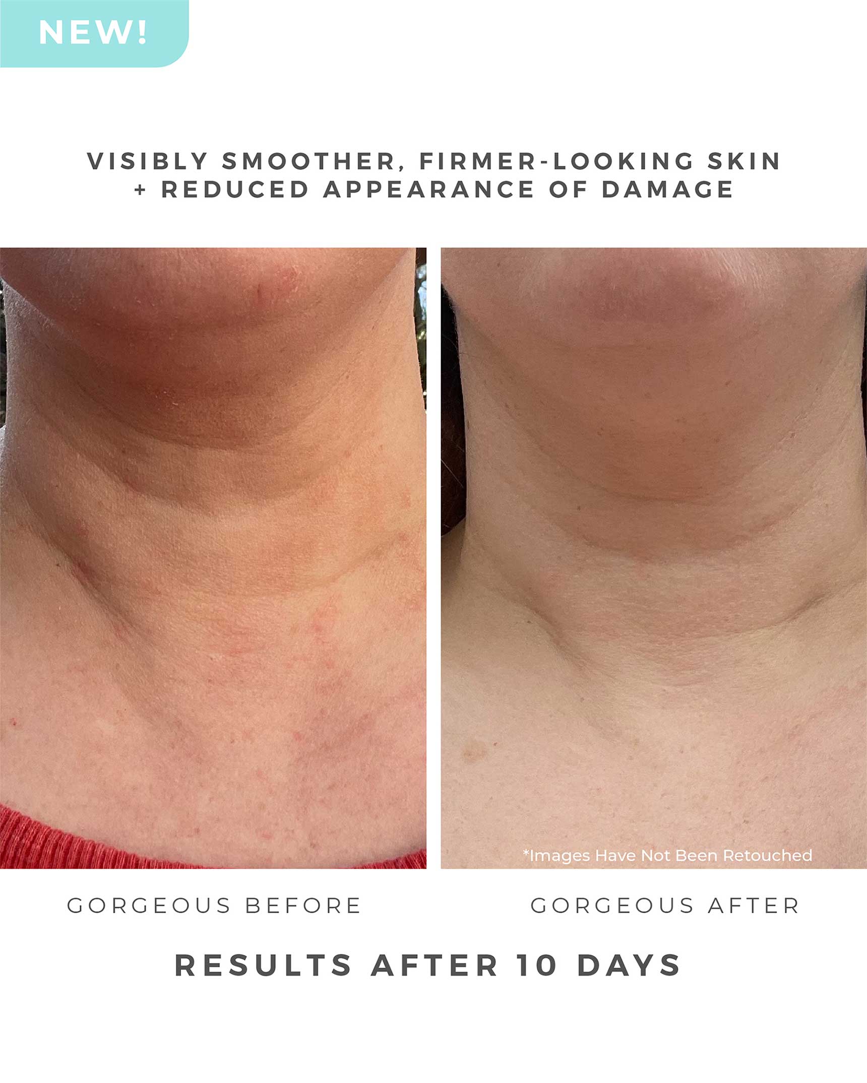 Azure Regenerative Neck Creme
